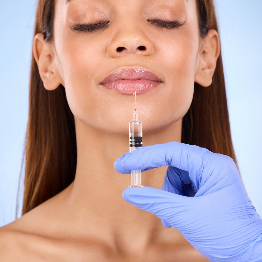 Woman with naturally enhanced lips after lip augmentation